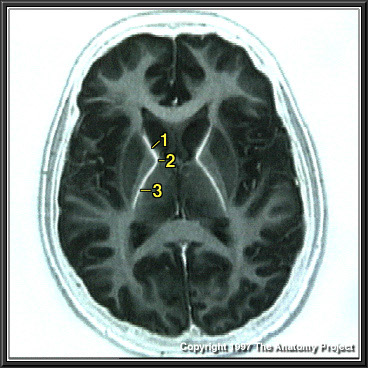 %_tempFileNameN1A5P5%