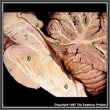 %_tempFileNameN2A3P1%