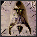 %_tempFileNameN1A4P4%