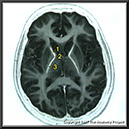 %_tempFileNameN1A5P5%