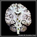 %_tempFileNameN2A1P3%