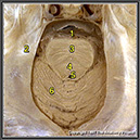 %_tempFileNameN2A3P2%