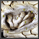 %_tempFileNamen1a2p14%