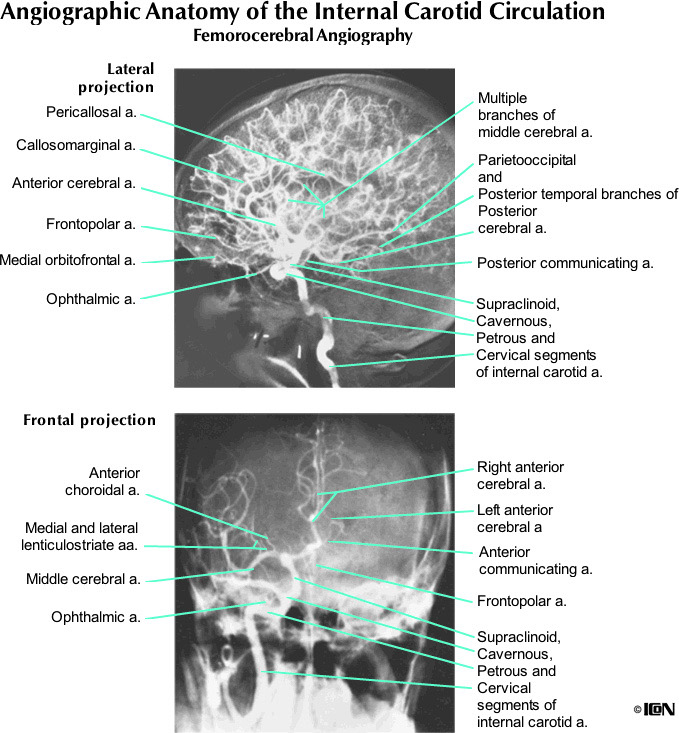 %_tempFileNameFigureI.53_l%