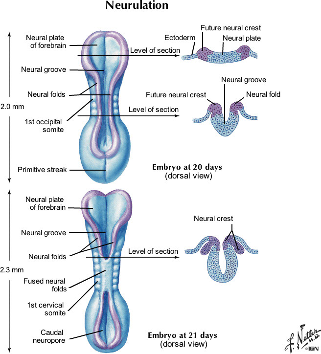%_tempFileNameFigureI.68_l%