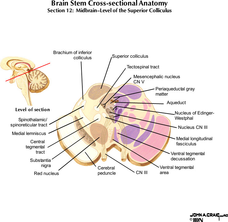 %_tempFileNameFigureII.63.12_l%