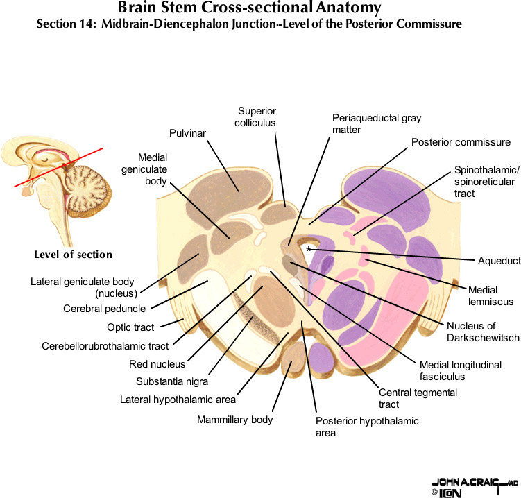 %_tempFileNameFigureII.63.14_l%