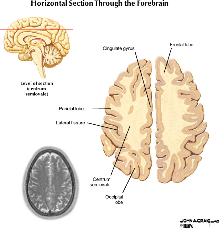 %_tempFileNameFigureII.87.10_l%
