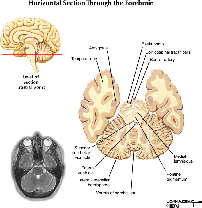 %_tempFileNameFigureII.87.2_l%