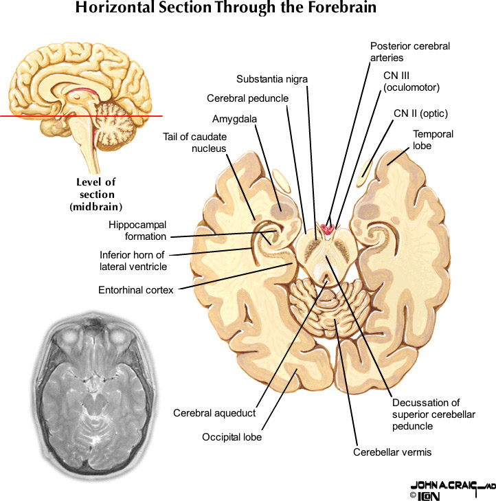 %_tempFileNameFigureII.87.3_l%
