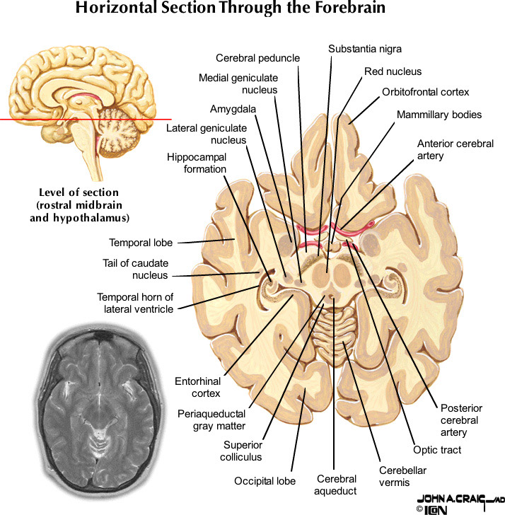 %_tempFileNameFigureII.87.4_l%