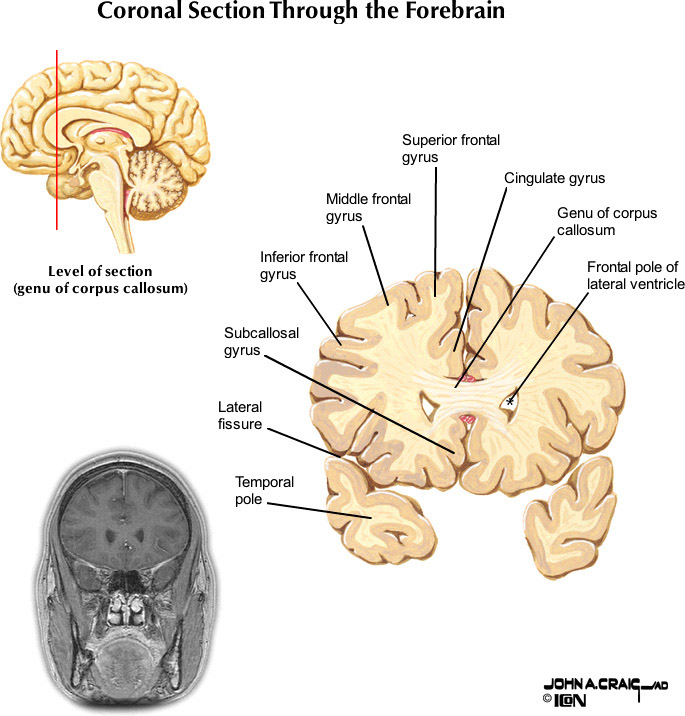 %_tempFileNameFigureII.88.1_l%