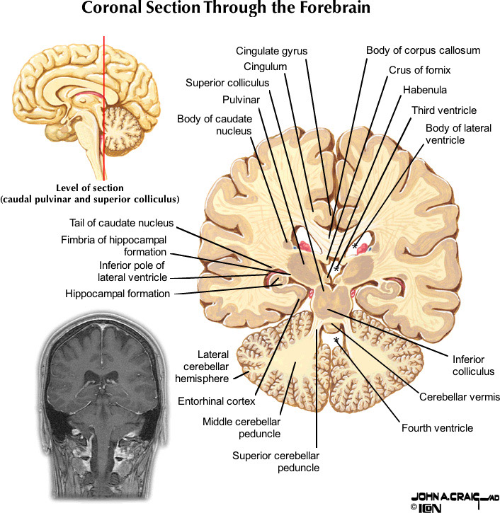 %_tempFileNameFigureII.88.9_l%