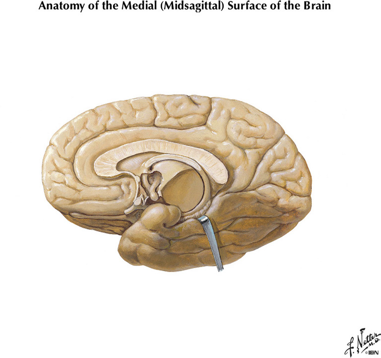 %_tempFileNameFigureI.22B%