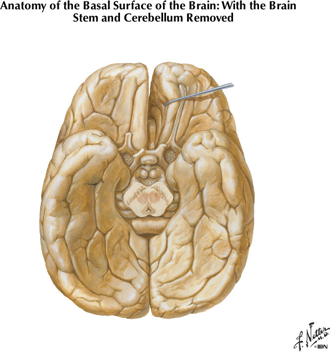 %_tempFileNameFigureI.25%