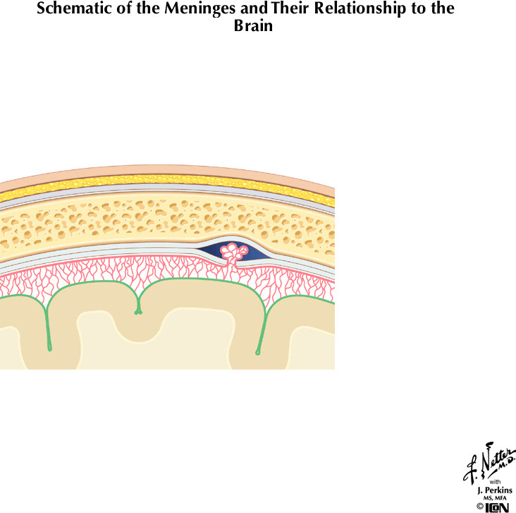 %_tempFileNameFigureI.41B%