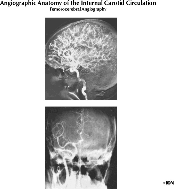 %_tempFileNameFigureI.53%