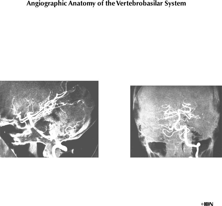 %_tempFileNameFigureI.54%