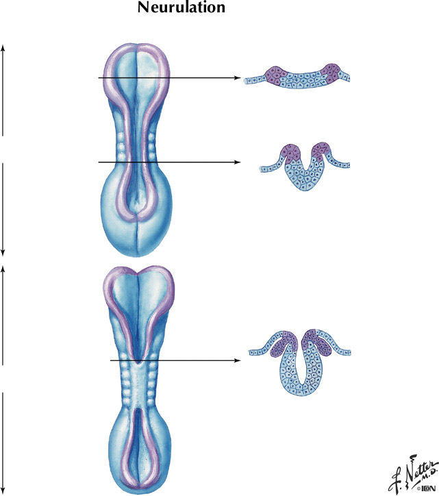 %_tempFileNameFigureI.68%