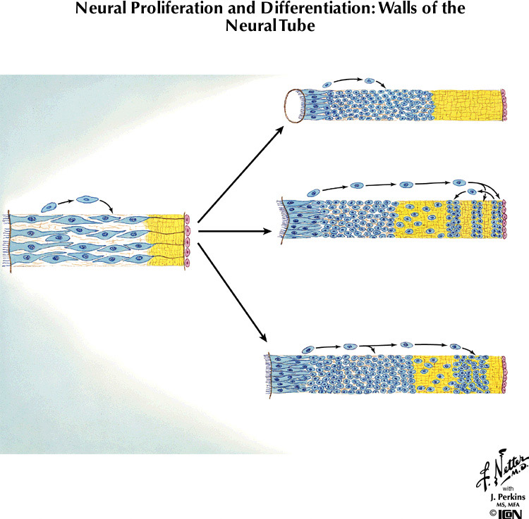%_tempFileNameFigureI.70%