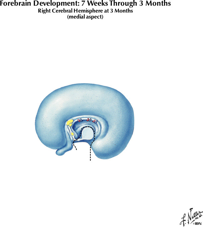 %_tempFileNameFigureI.75E%