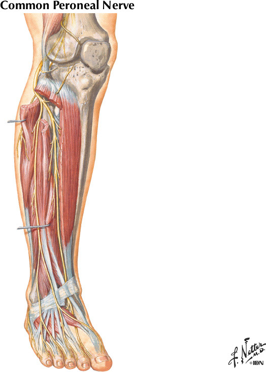 %_tempFileNameFigureII.31A%