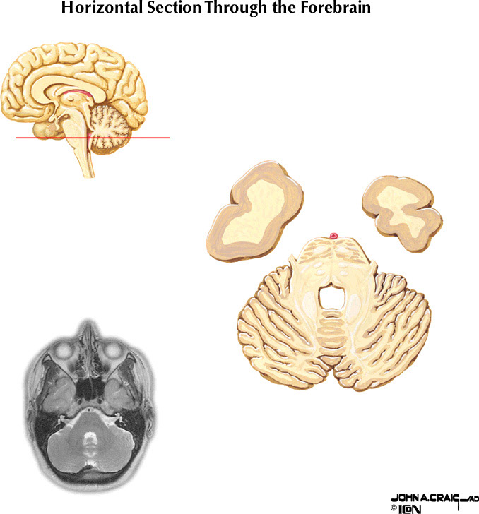 %_tempFileNameFigureII.87.1%