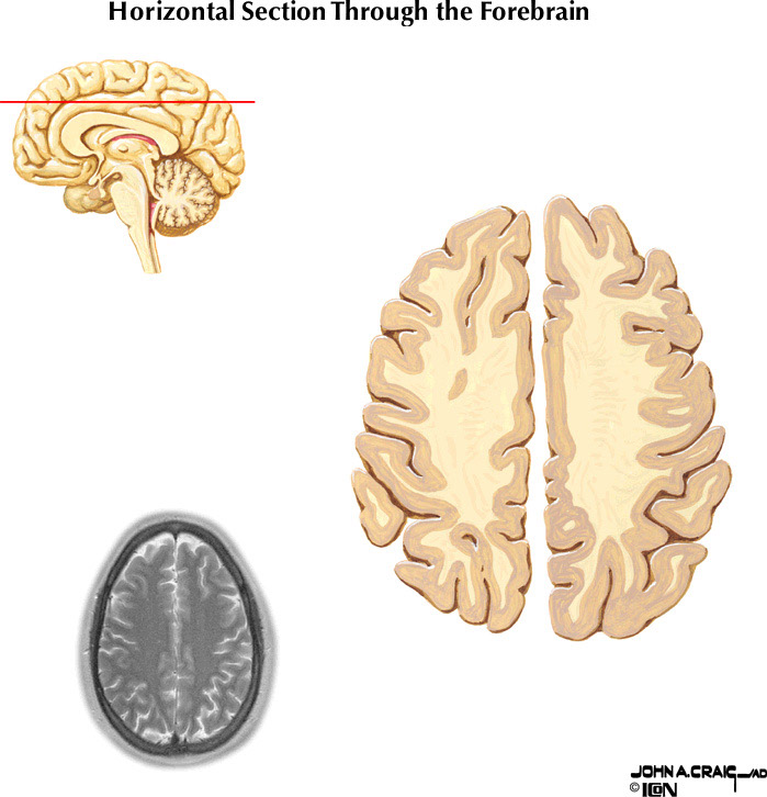 %_tempFileNameFigureII.87.10%