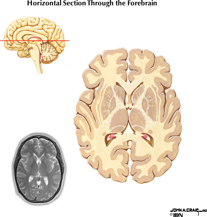%_tempFileNameFigureII.87.6%
