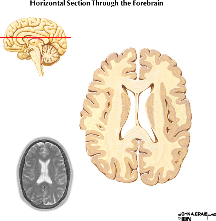 %_tempFileNameFigureII.87.8%