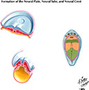 %_tempFileNameFigureI.67%